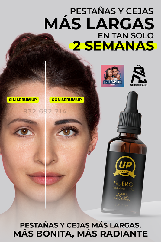 SERUM UP !
